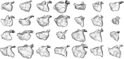 Learning spatiotemporal statistical shape models for non-linear dynamic anatomies
